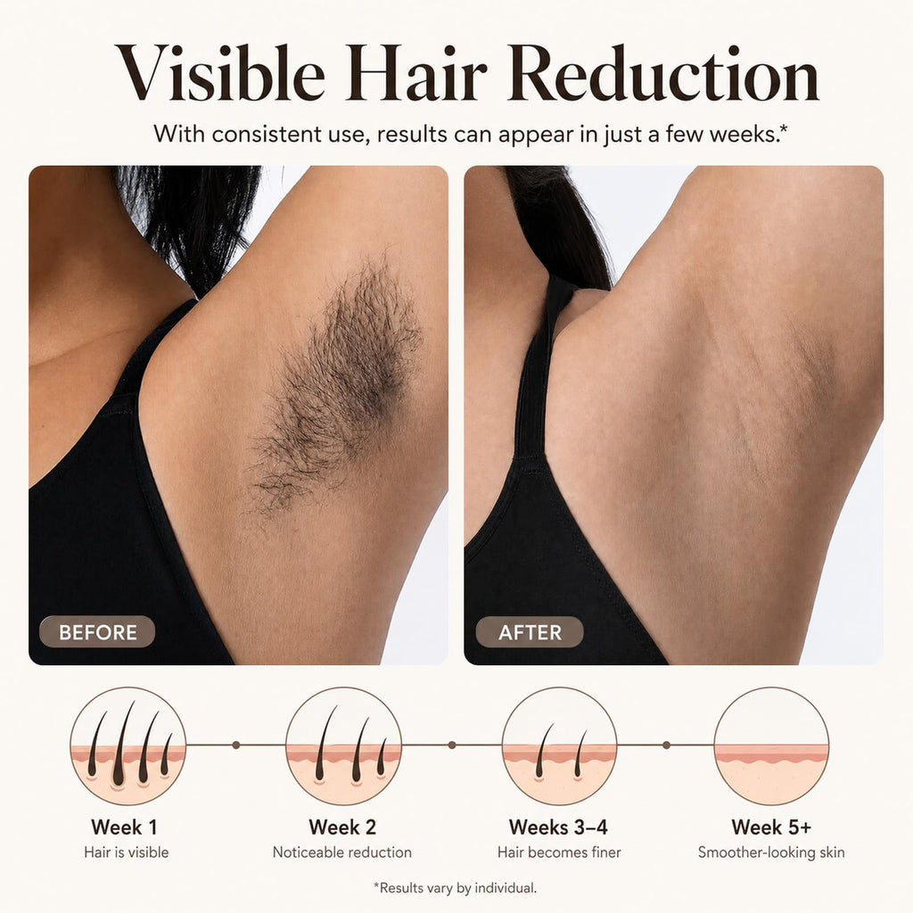Laser Hair Removal Device X99027